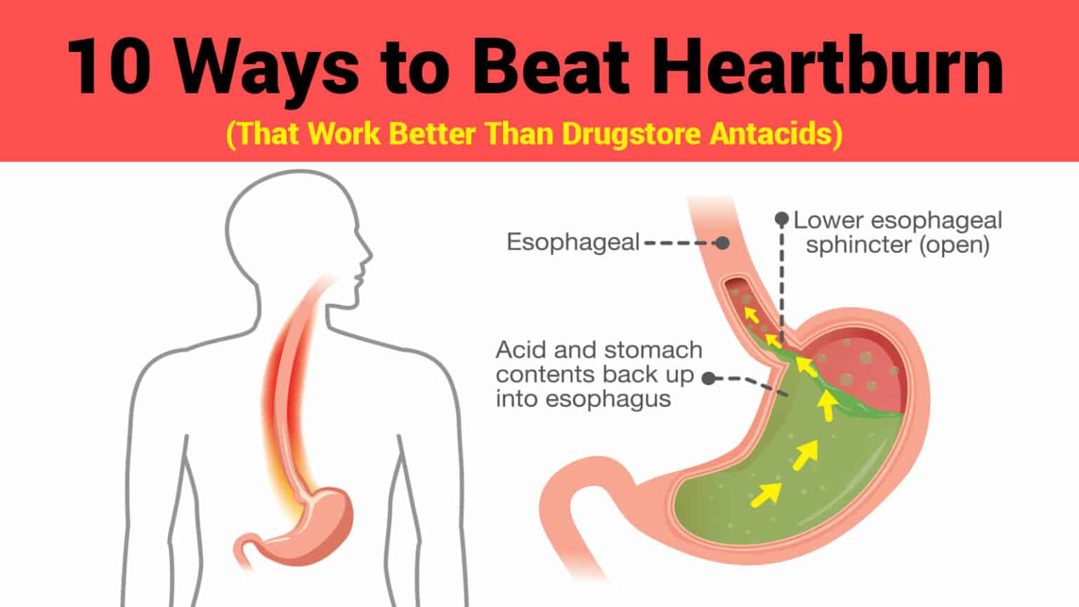 10 Ways to Beat Heartburn (That Work Better Than Drugstore ...