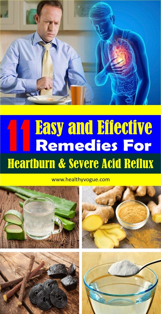 11 Easy and Effective Remedies for Heartburn &  Severe Acid ...