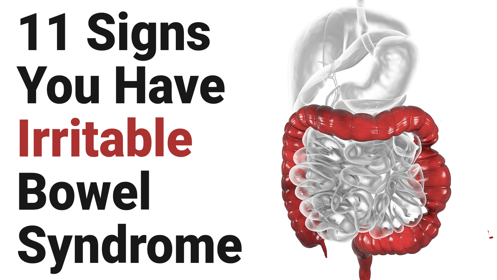 11 Signs You Have Irritable Bowel Syndrome