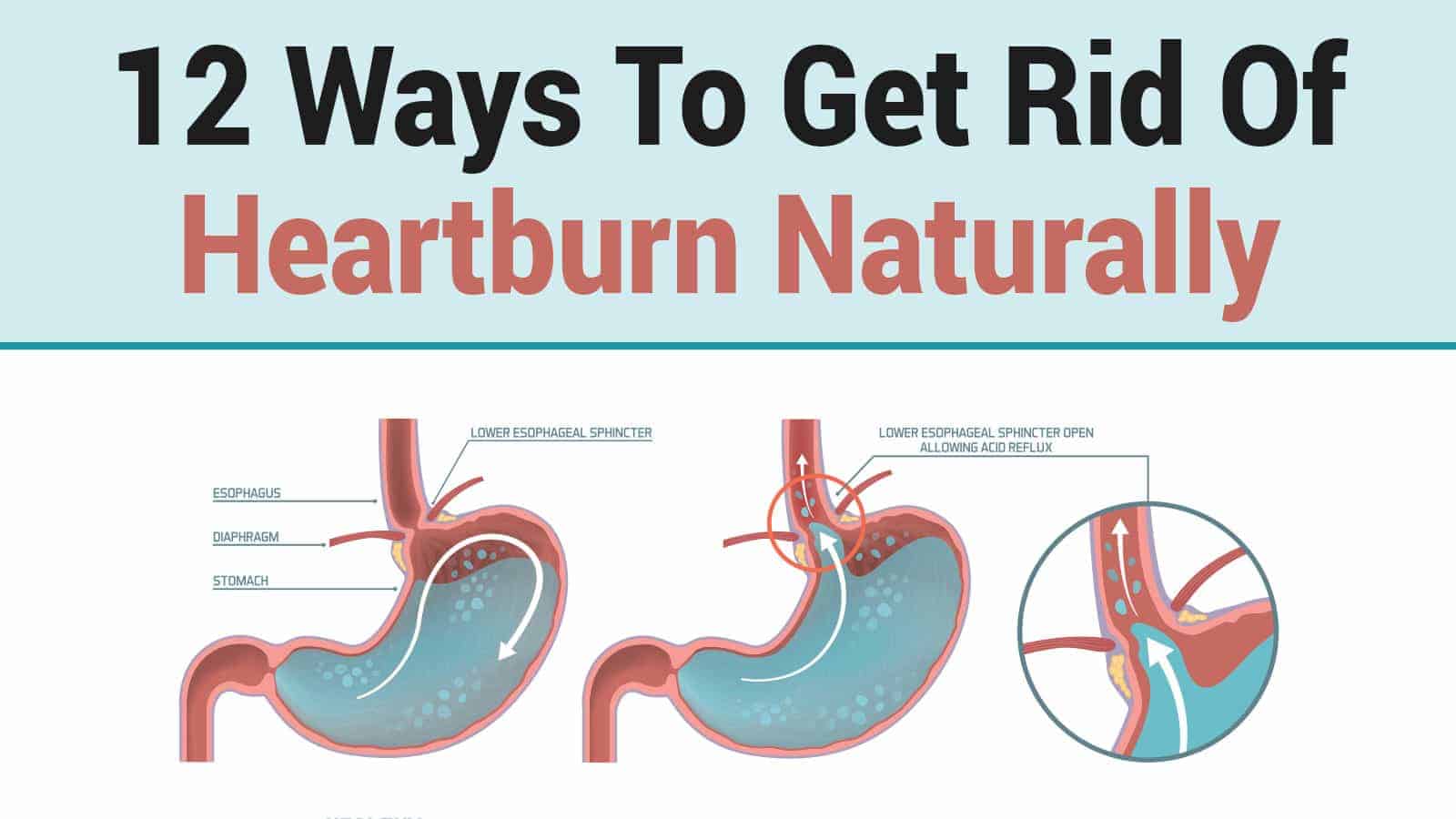 12 Ways To Get Rid Of Heartburn Naturally