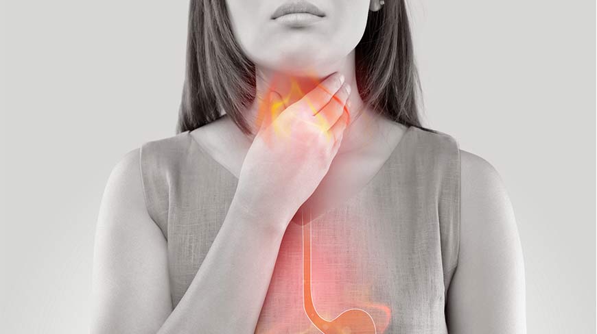14 Surprising Facts About Heartburn and GERD ...