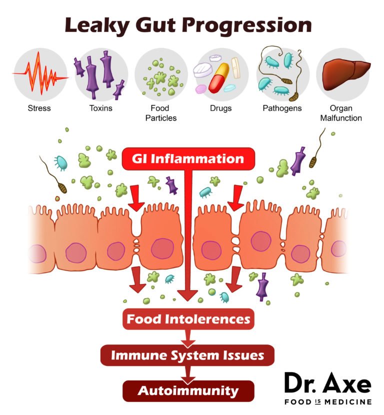 3 Steps to Heal Leaky Gut and Autoimmune Disease