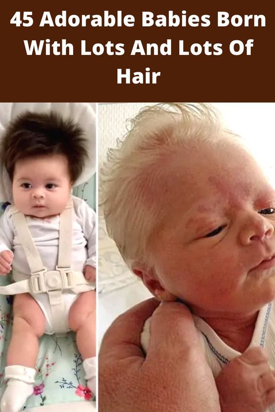 37 Best Photos Does Heartburn Make Your Baby Hair Grow ...
