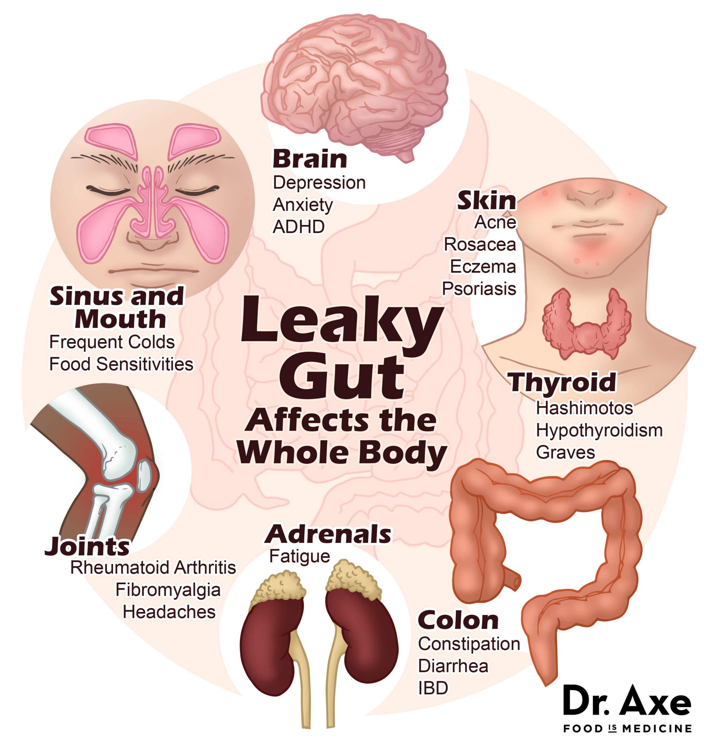 4 Steps to Heal Leaky Gut and Autoimmune Disease ...