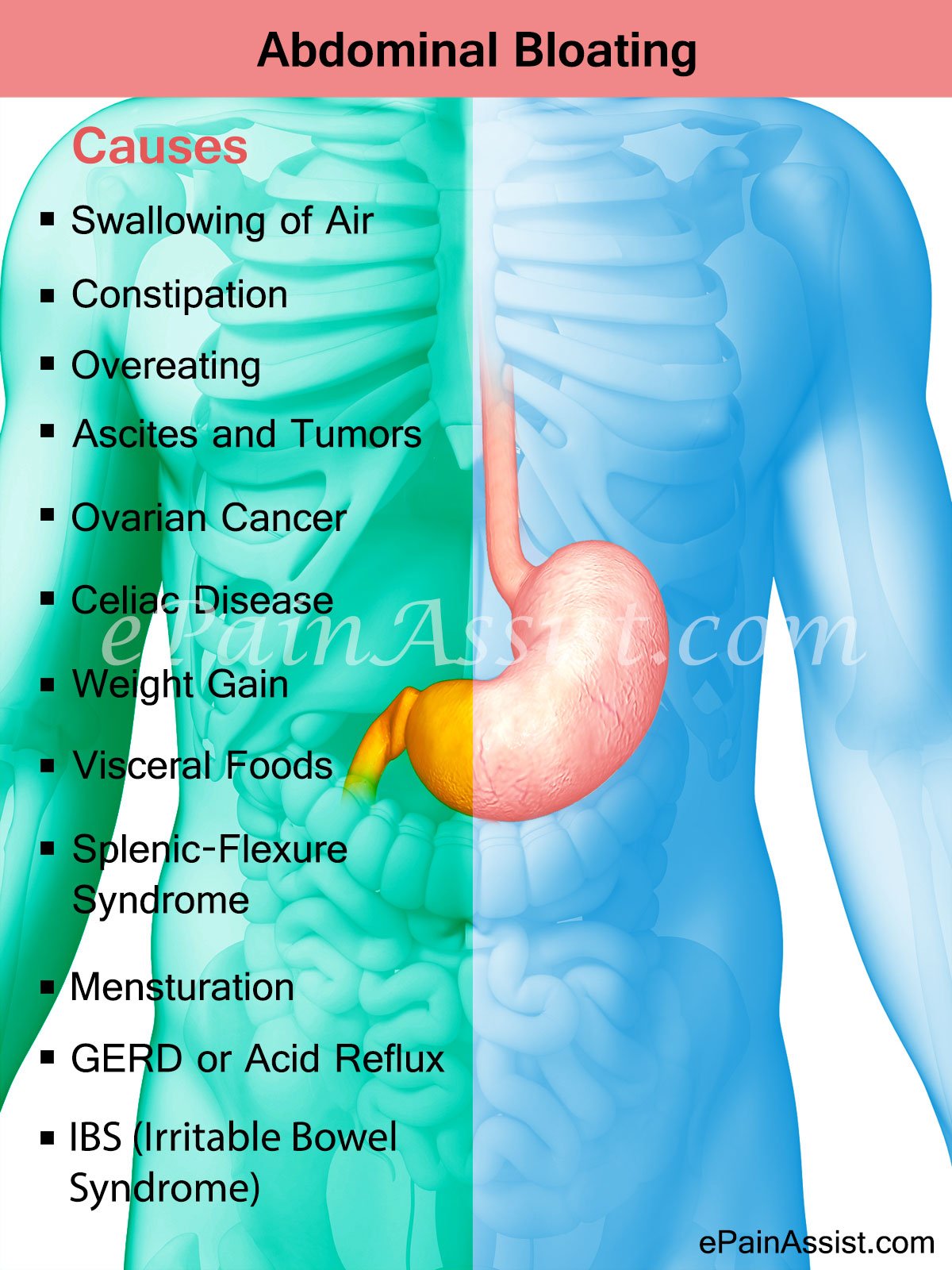 Abdominal Bloating: Home Remedies and Prevention Tips