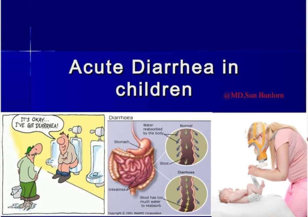 Acute Diarrhea in Children