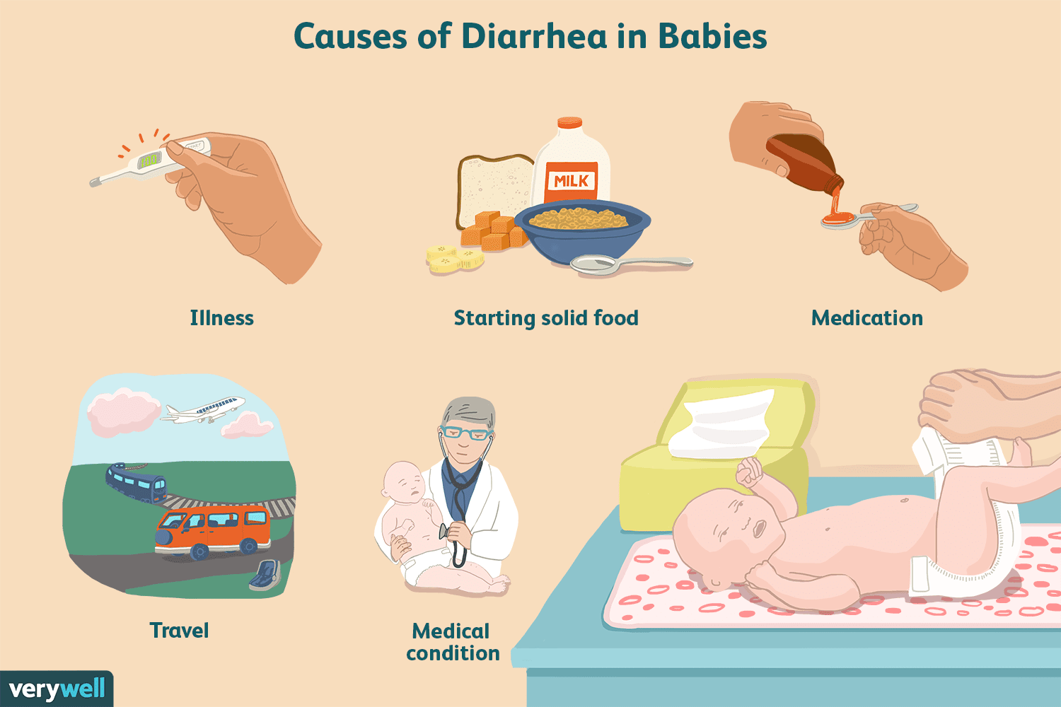 Appearance, Causes, and Treatment of Baby Diarrhea