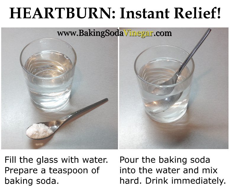 Baking soda for heartburn
