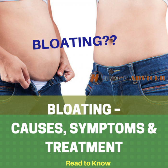 Bloating: Causes, Picture, Symptoms and Treatment