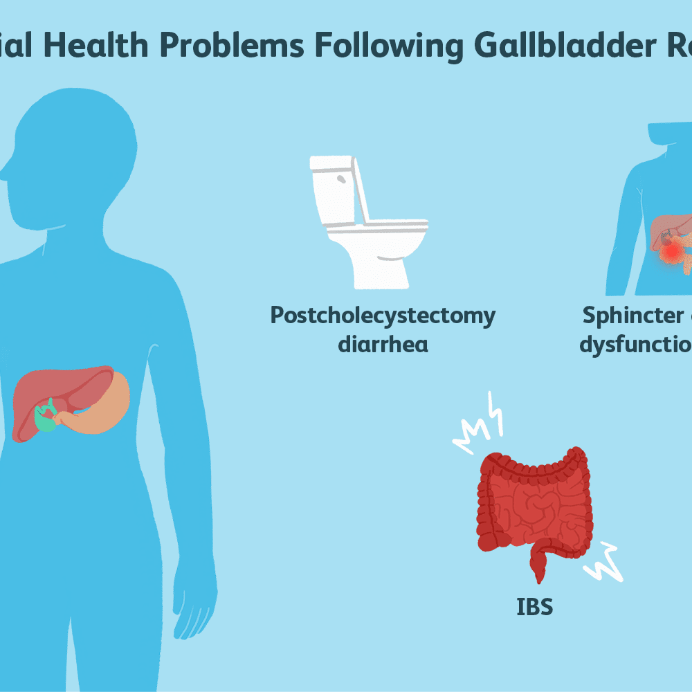 Blood In Stool After Gallbladder Surgery