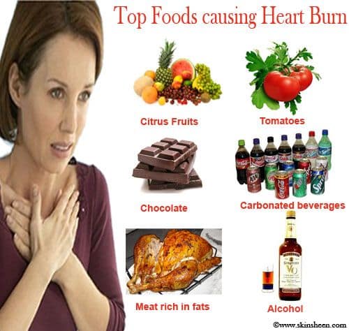 Causes of Heartburn, What Food Causes Heartburn, Symtoms of Heartburn ...
