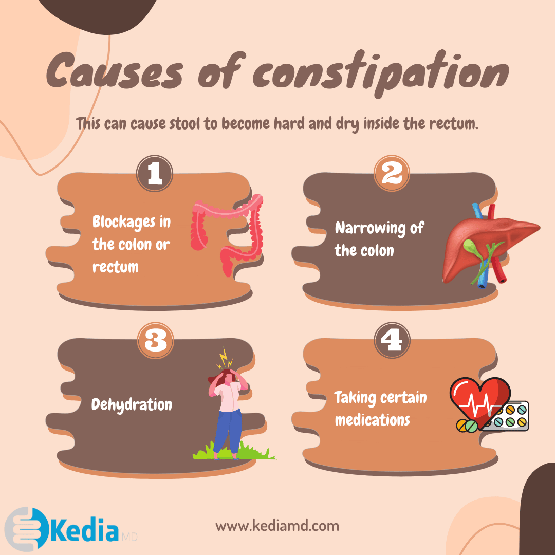 Constipation Symptoms, Causes, and Treatment in Dallas