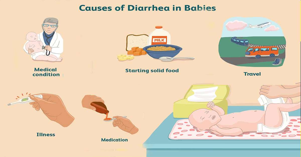 Diarrhea In Babies  Causes, Symptoms And Treatment