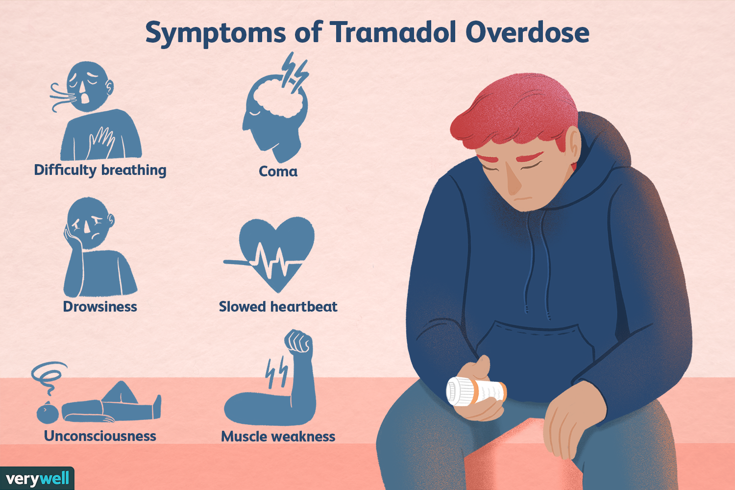 Does Tramadol Cause Constipation