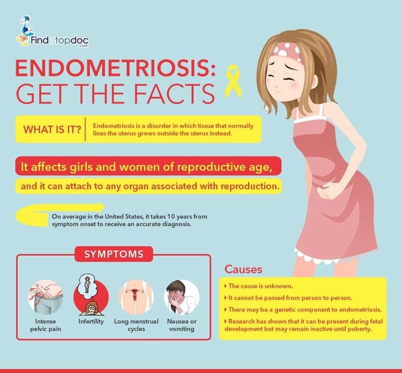 Endometriosis: Signs and Symptoms