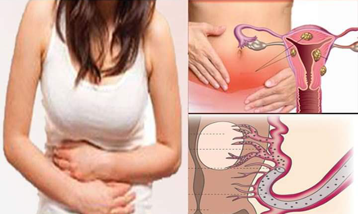 Festive Period: 13 Remedies of Constipation Discomfort ...