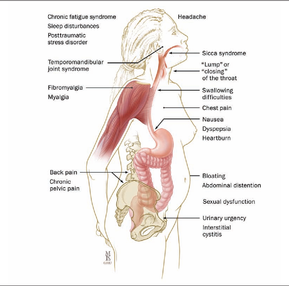 Figure 1 from Managing irritable bowel syndrome ...