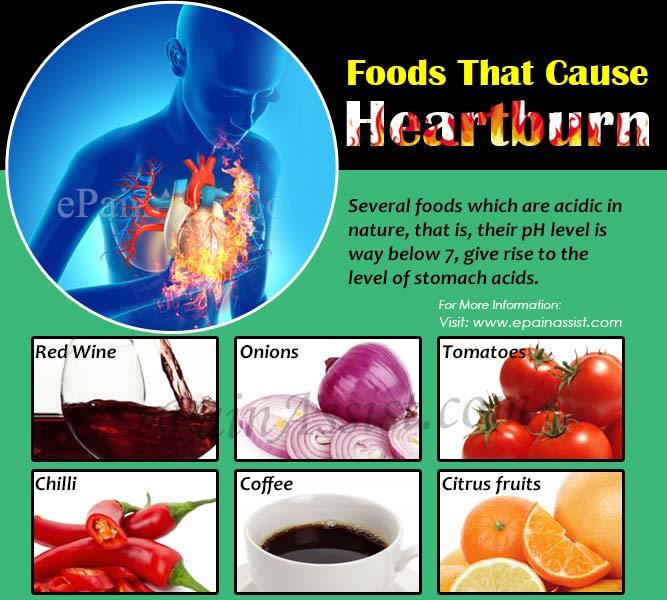 Foods That Cause Heartburn: Tomatoes, Garlic, Onions, Peppermint ...