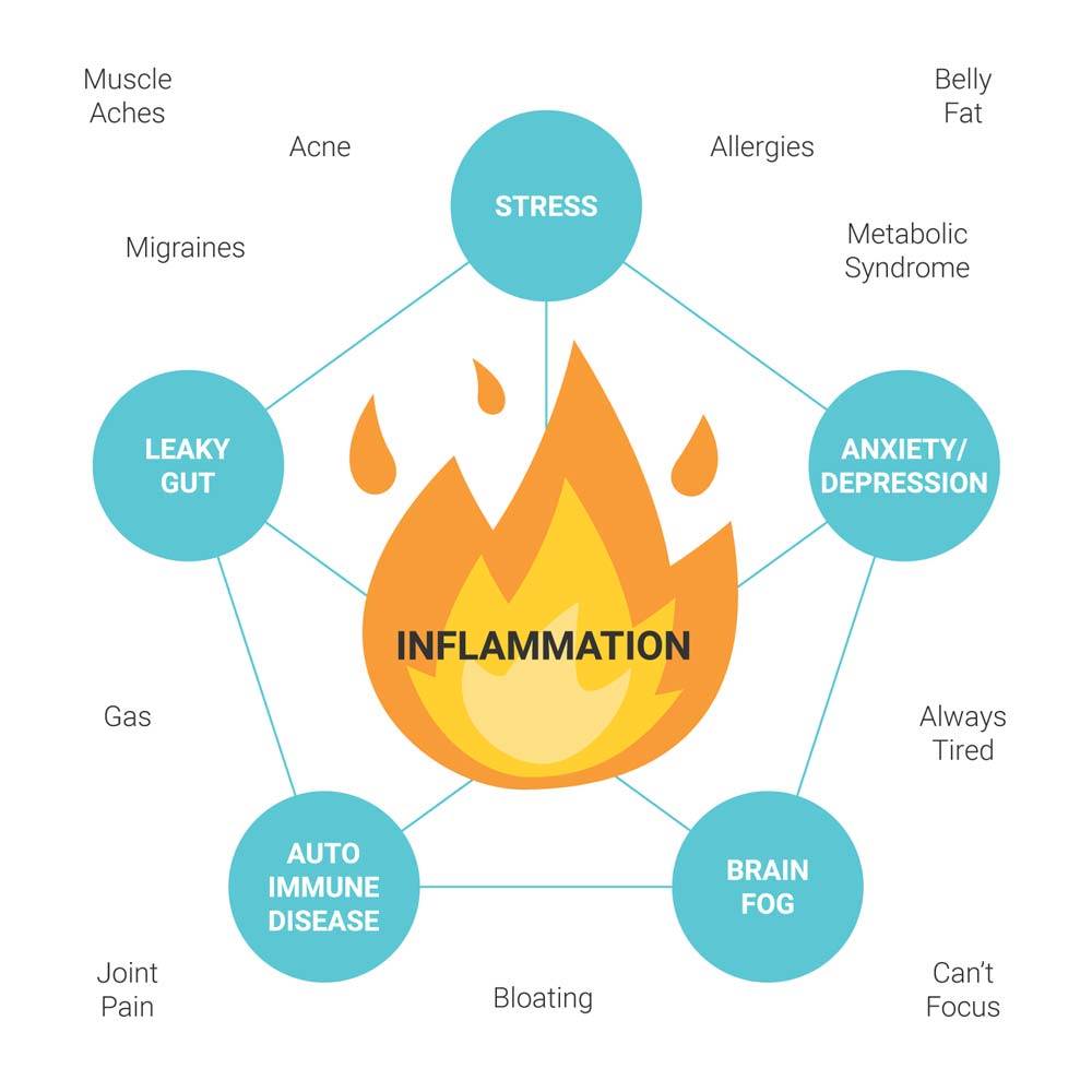 Hereâs Everything You Need To Know About Inflammation ...