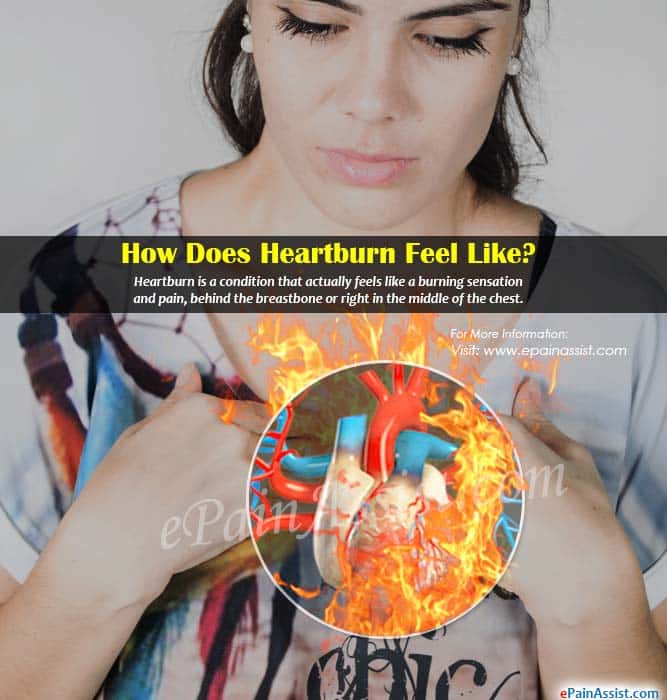How Does Heartburn Feel &  What Could be Causing it?