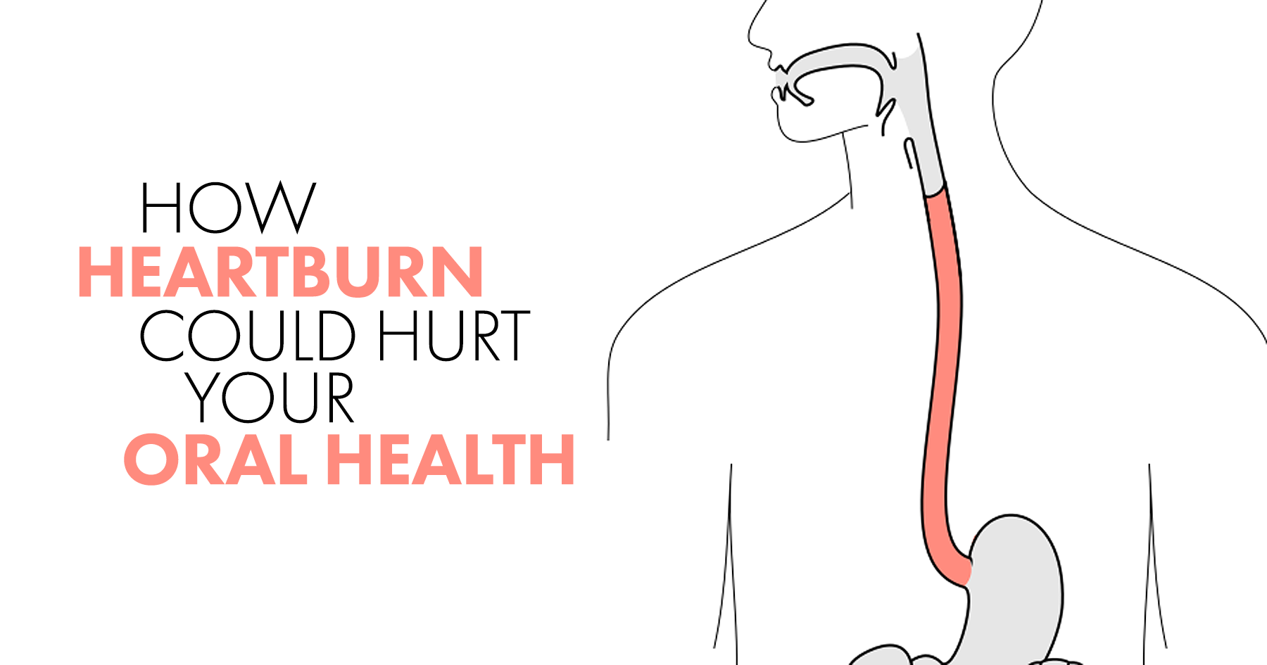 How Heartburn Can Ruin Your Teeth