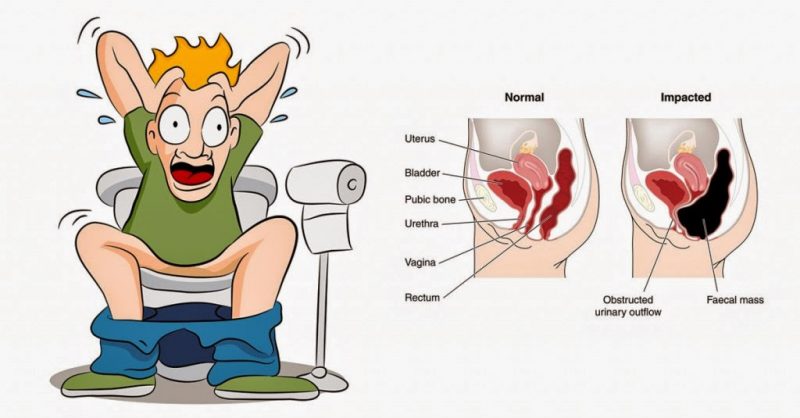 How to cure constipation fast, ALQURUMRESORT.COM