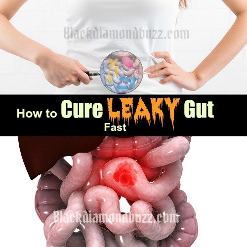 How to Heal Leaky Gut Naturally