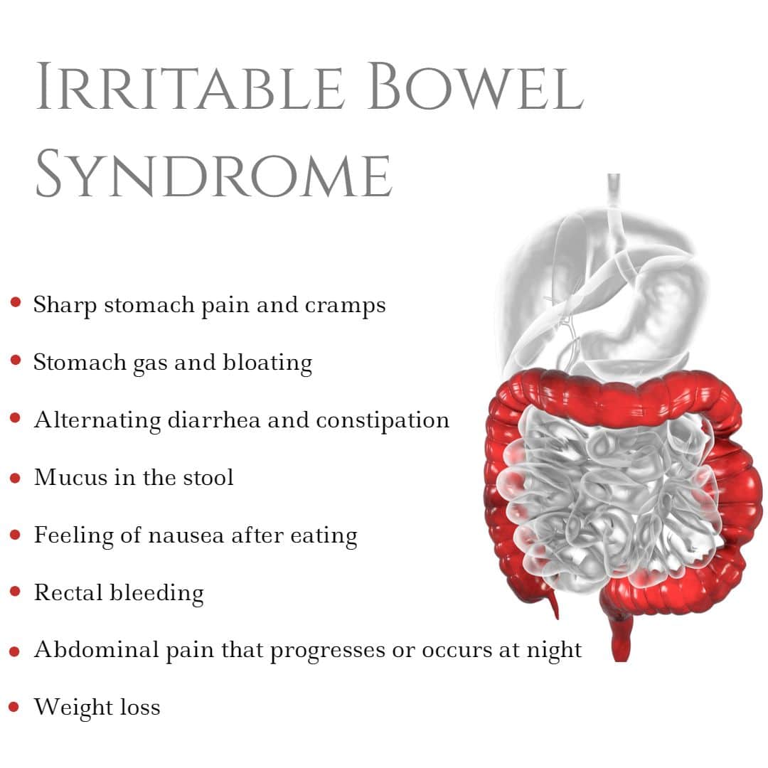 How To Help My Irritable Bowel Syndrome â ho.modulartz.com