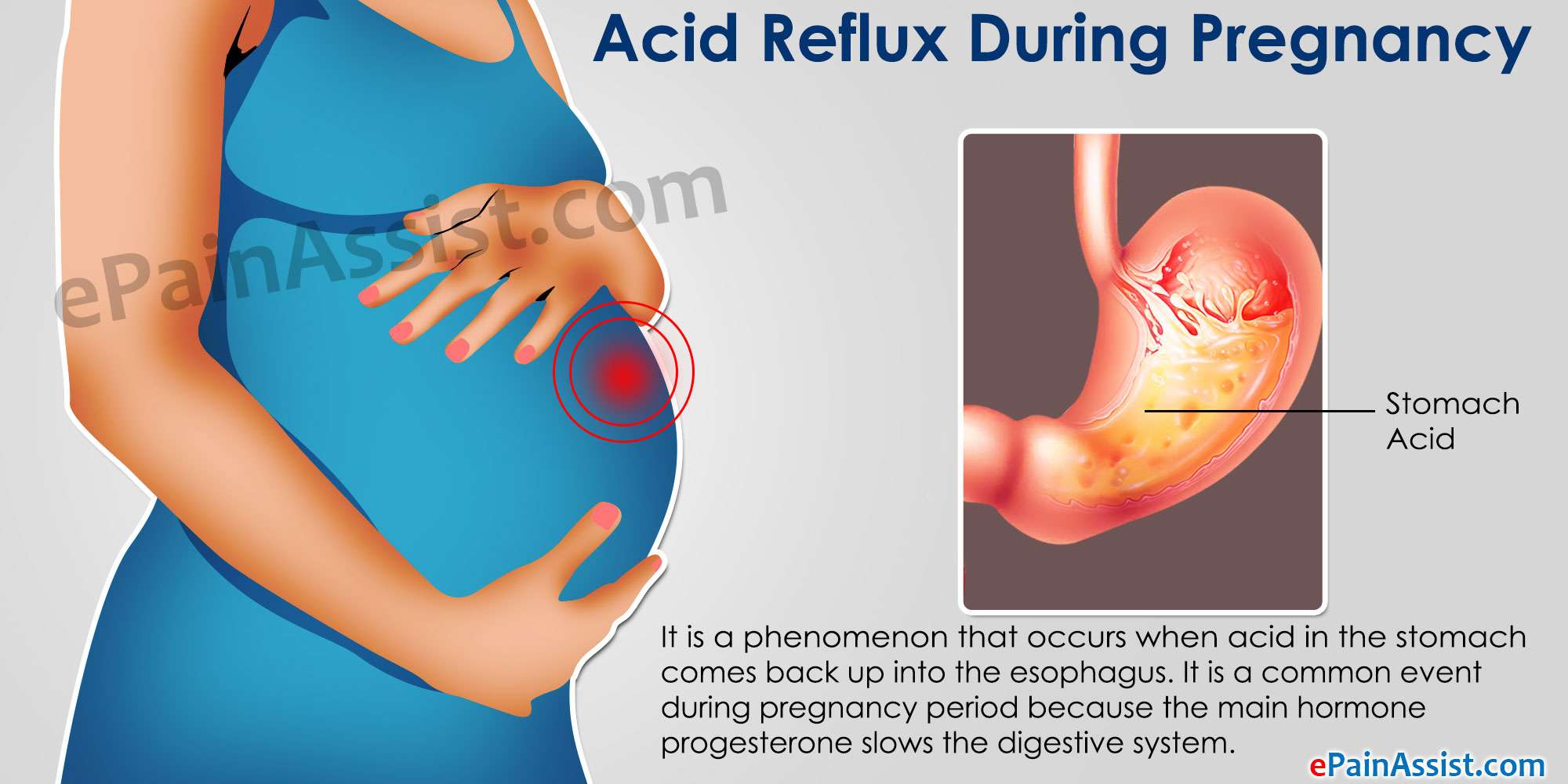 Indigestion And Reflux Causes Pregnancy Early During
