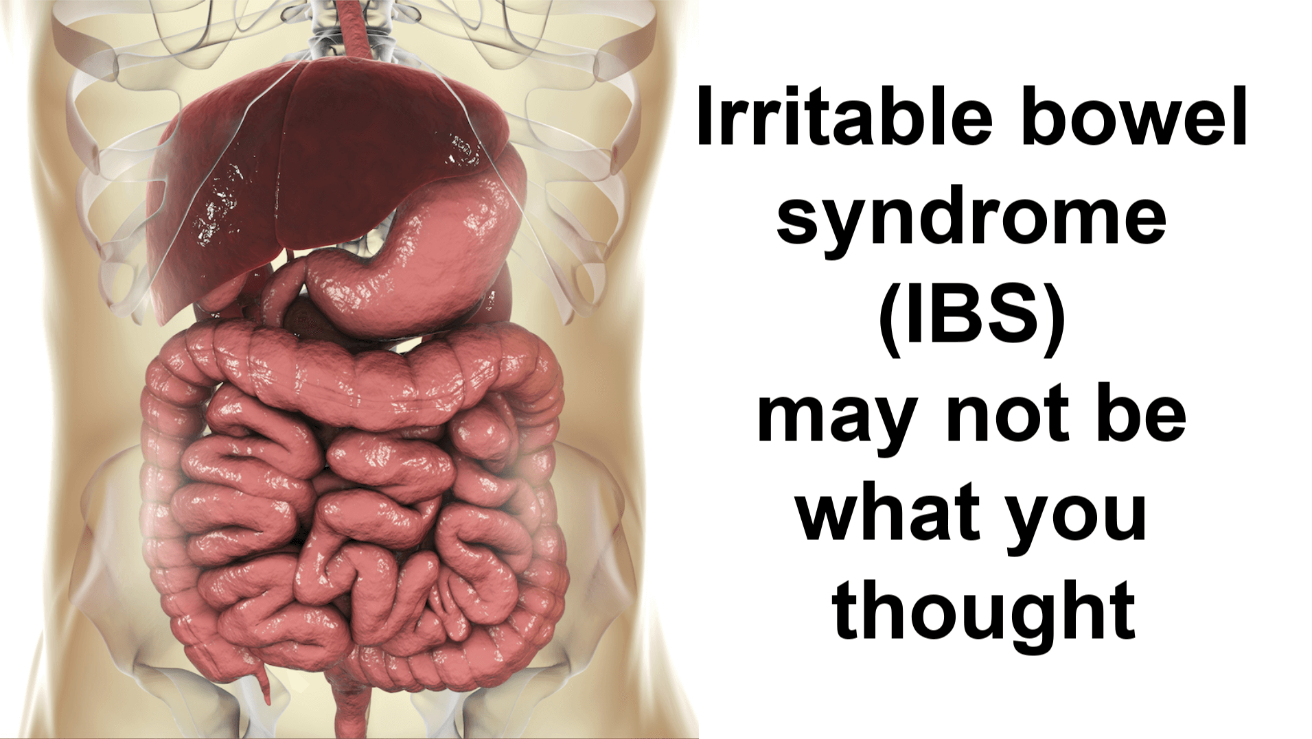 Irritable bowel syndrome (IBS) may not be what you thought ...