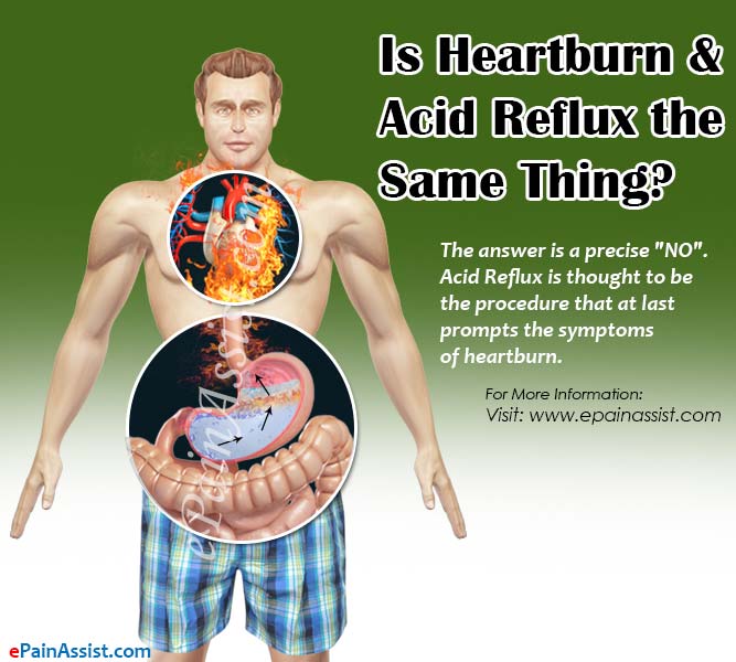 Is Heartburn & Acid Reflux the Same Thing?
