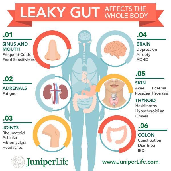 Leaky Gut Syndrome â Its More Common Than You Think