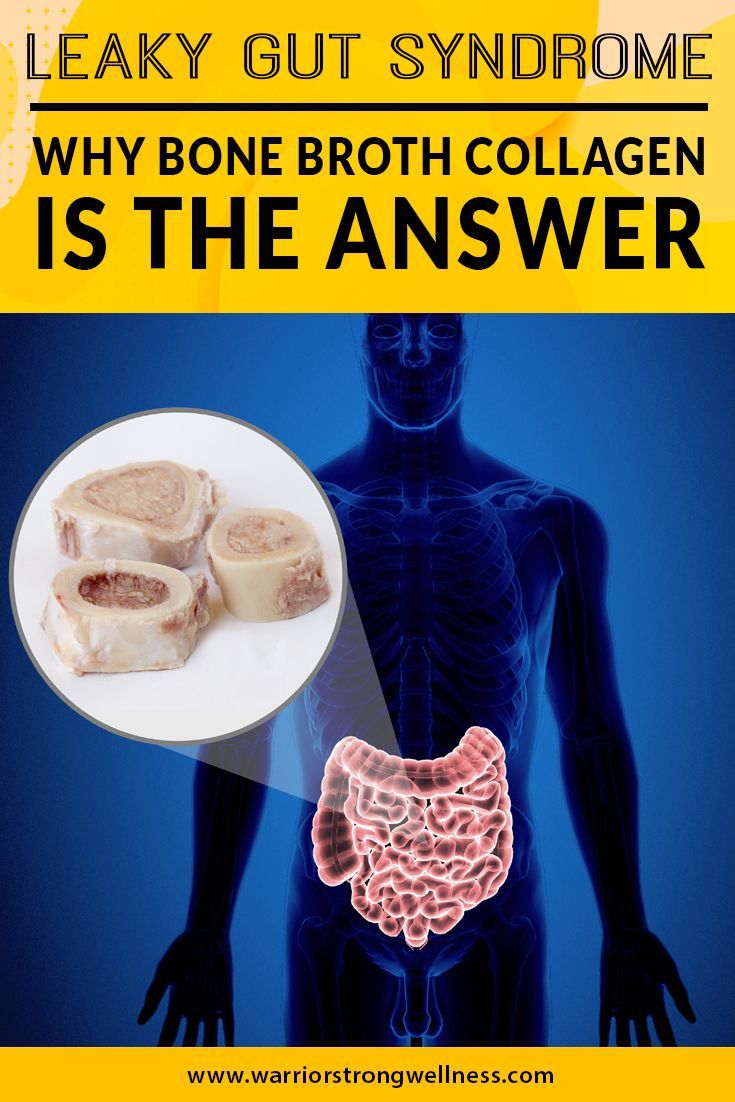 Leaky Gut Syndrome â Why Bone Broth Collagen Is the Answer ...