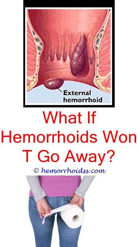 Pin on Hemorrhoids Symptoms