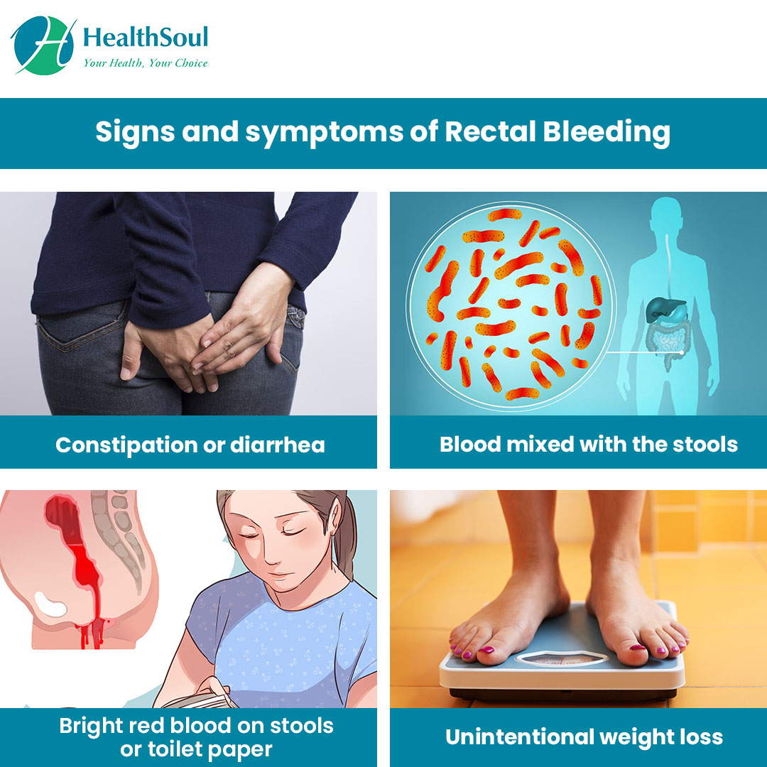 Rectal Bleeding: Causes and Treatment