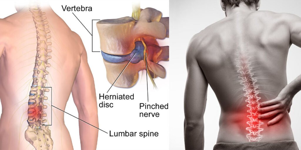 Top 10 causes of lower back pain you should know