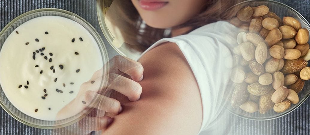 Using Probiotics for Eczema Can Help Heal Your Skin ...
