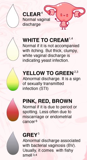 Vaginal Discharge: The Color Stain &  What Does It Mean ...