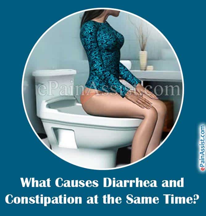 What Causes Diarrhea and Constipation at the Same Time?