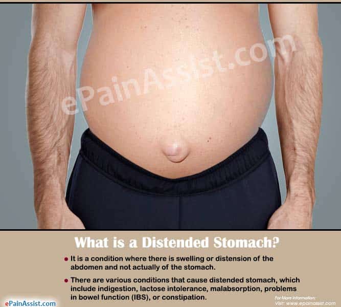 What Causes Distended Stomach &  How is it Treated?