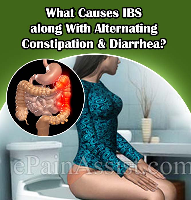 What Causes IBS along With Alternating Constipation ...