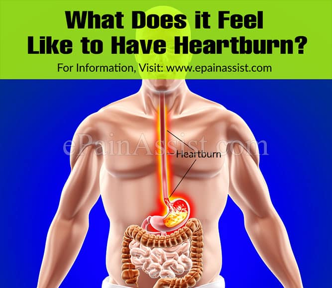 What Does it Feel Like to Have Heartburn?