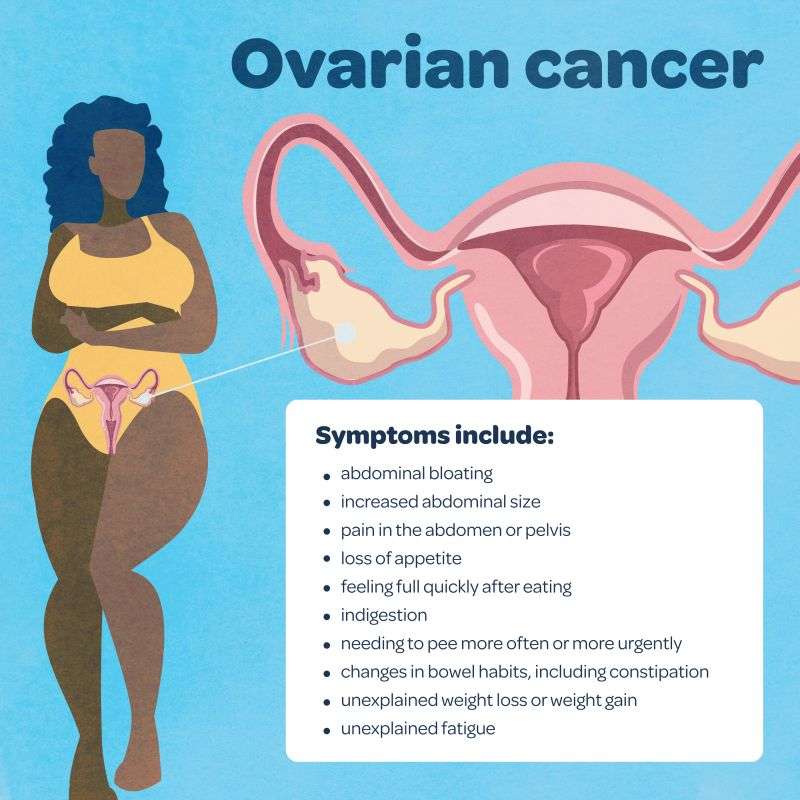 What is gynaecological cancer and what are the symptoms ...