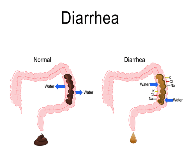 Why do certain foods cause diarrhea immediately after eating them?
